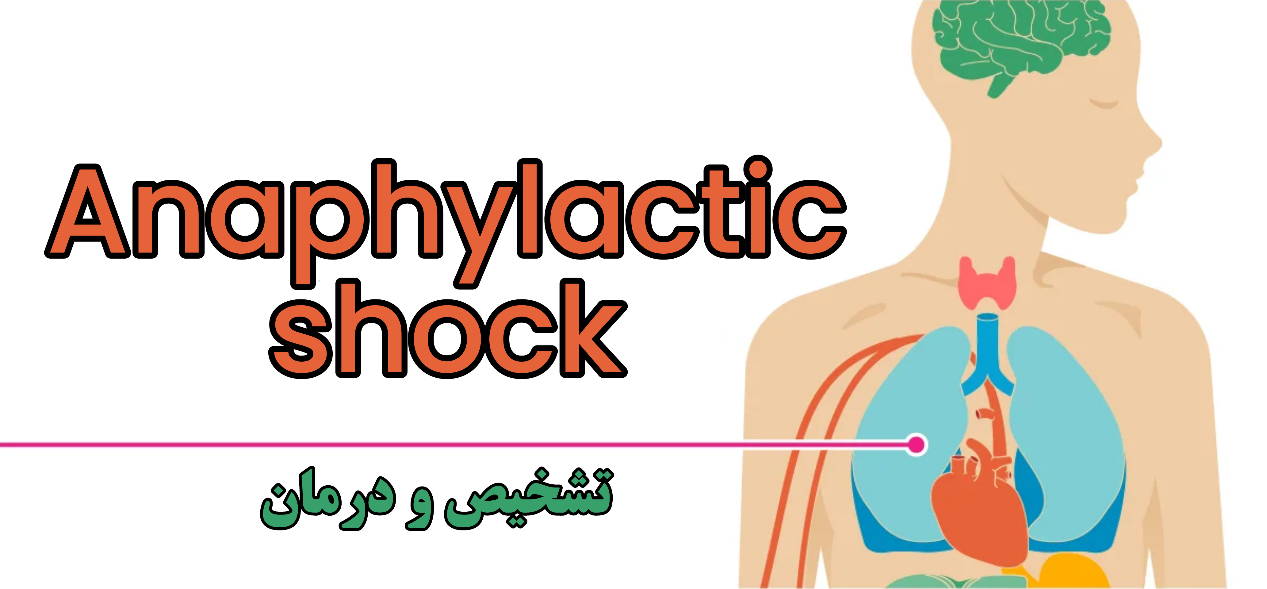 شوک آنافیلاکسی | Anaphylactic shock